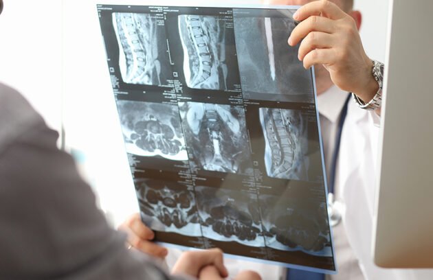 Tüm Spinal Mr