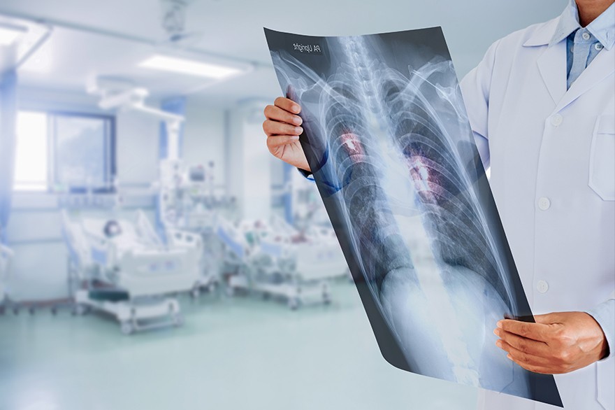 Akciğer Tomografisi (Toraks BT)