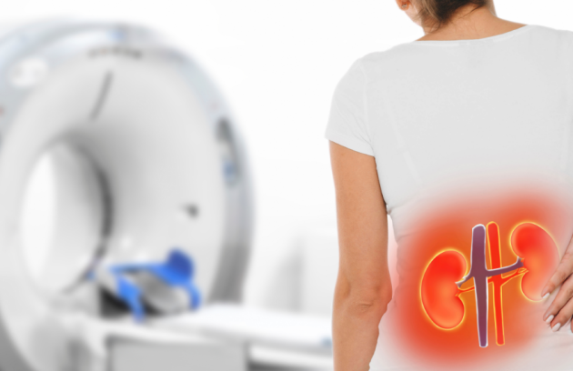 Böbrek Tomografisi (Renal BT)