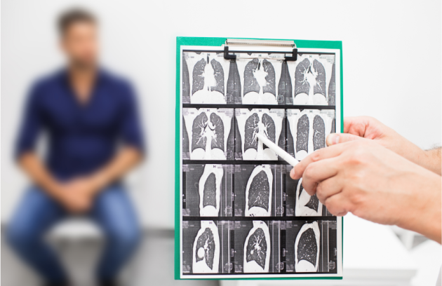 Pulmoner BT Anyijografi