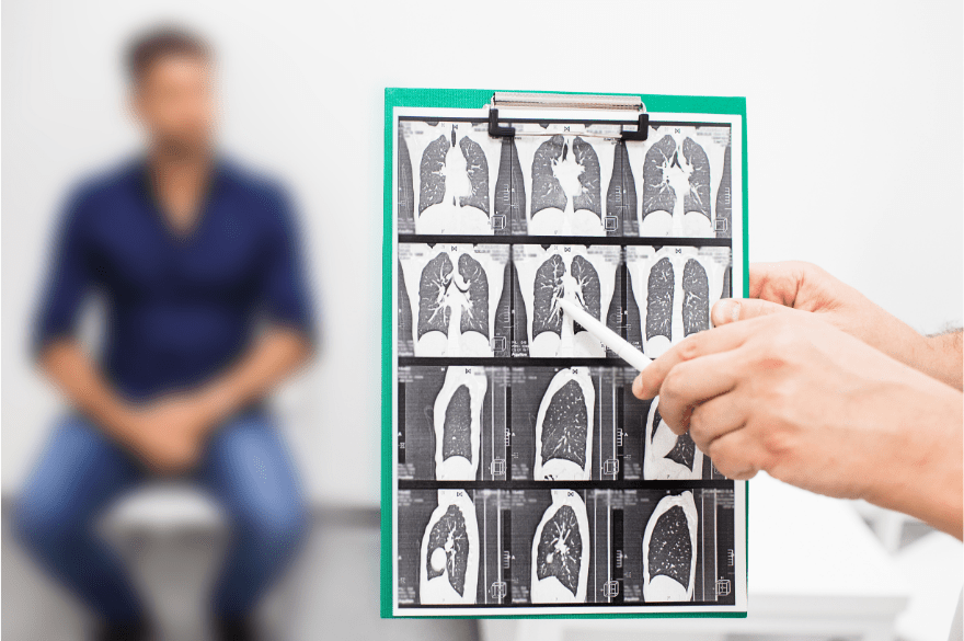 Pulmoner BT Anyijografi